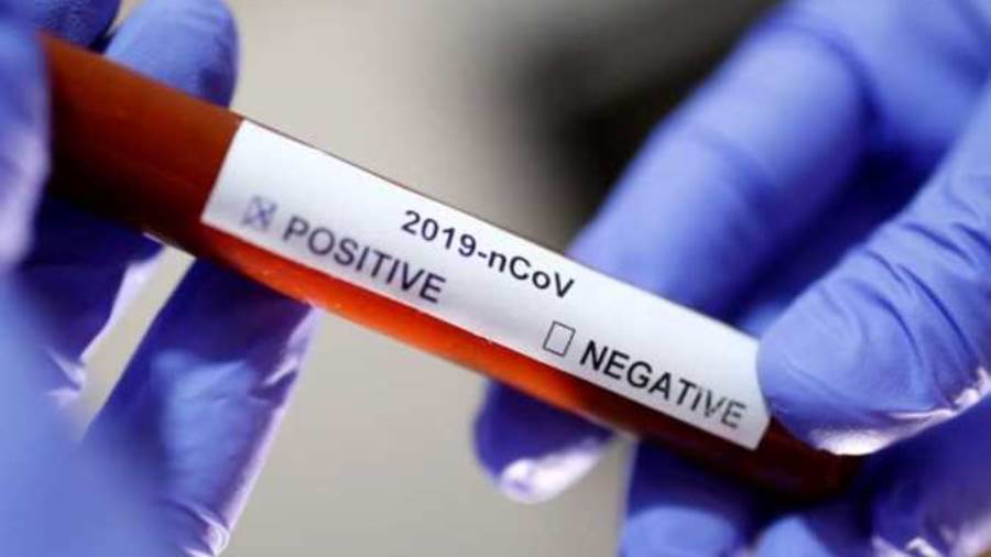 مدير منظمة الصحة: 2650 إصابة مؤكدة بكورونا و49 وفاة في إفريق