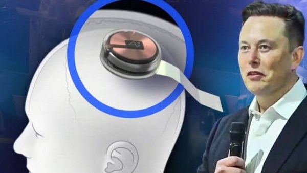Musk’s Neuralink